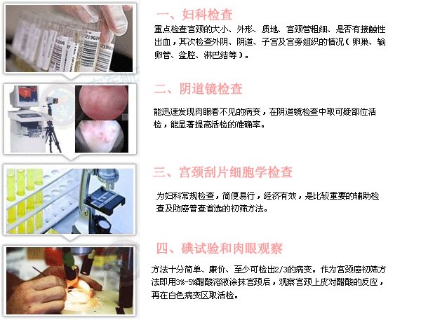 宫颈炎的检查